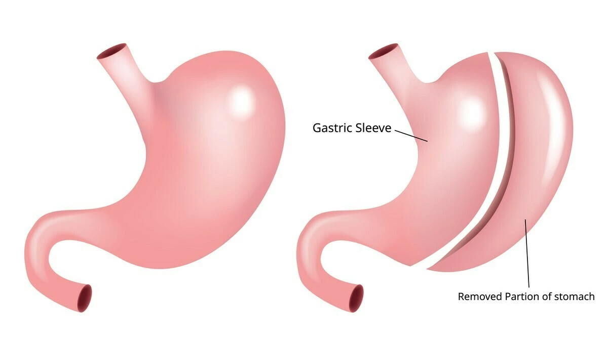 ezgif.com-gif-maker (39)