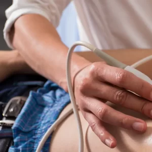 Stress Echocardiography